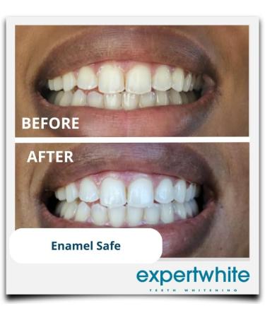 QuickGlo Rapid 35% Carbamide Peroxide Teeth Whitening Gel - Dentist Grade Refill Syringes (4x3cc) for Fast White Teeth - Made in USA - Buy Online on GoSupps.com