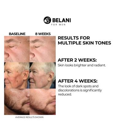 Belani Harumi Serum - Serum for Men Wrinkle removal anti-aging Reduces Dark Spots moisturizing soothing for Face smooth and healthy skin (1.01 Fl. Oz) 1 Box - Buy Online on GoSupps.com