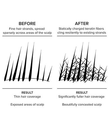 Hair Building Fiber Hair Loss Concealer - Dark Brown (28g) | Instant Volume & Fullness | International Shipping Available - Buy Online on GoSupps.com