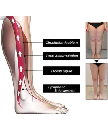 Tsadeer 4-Pack Adjustable Lymphatic Drainage Therapy Magnetic Rings - Unisex Alloy Wellness Accessories - Buy Online on GoSupps.com