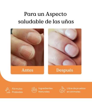 Health Routine Kit Croissance et R paration Ongles : Stylo Soin au Tea Tree + S rum Croissance la Biotine et Jojoba | Durcisseur et Fortifiant pour Ongles Cassants Mous et Ab m s - Buy Online on GoSupps.com