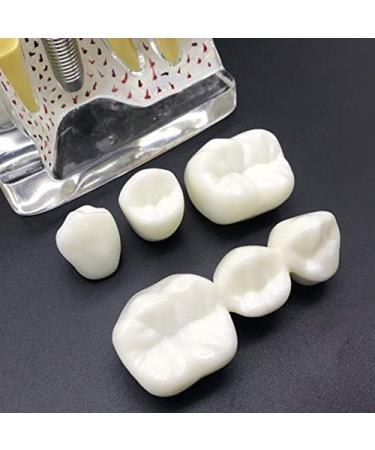 4x Enlarged Teeth Model for Dental Education | Implant & Crown Simulation | Ideal for Teaching & Demonstration - Buy Online on GoSupps.com