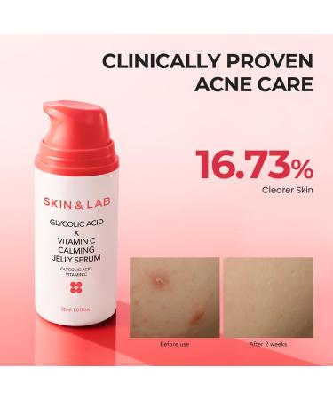  SKIN&LAB GLYCOLIC ACID X VITAMIN C CALMING JELLY SERUM 1.01 fl. oz. - Buy Online on GoSupps.com