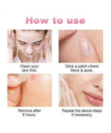 Acne Cover Patches with Salicylic Acid - 144pc Hydrocolloid Spot Treatment for Pimples & Whiteheads | Overnight Blemish Care - Buy Online on GoSupps.com