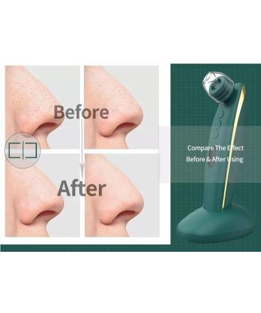 Elegant WiFi Pore Cleanser with 5MP HD Camera, Acne Extractor Vacuum, Blackhead Remover, Dermabrasion Machine - White - Buy Online on GoSupps.com