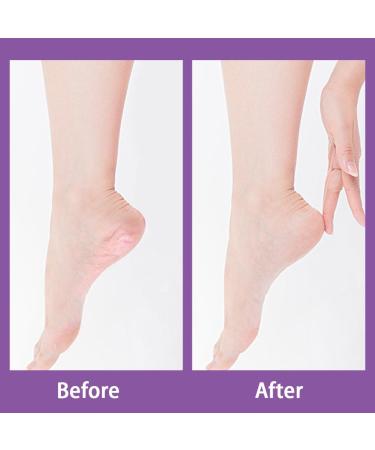 Foot File Callus Remover Double-Sided Foot File Pedicure Rasp Foot File Foot Rasp for Hand Feet Care Removing Dead Skin Tools Effective Removal Dead Skin Callus Cracked Skin(Pink) - Buy Online on GoSupps.com