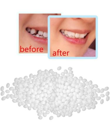 Natural Contraception Device & Dental Repair Kit | Temporary Prosthesis Adhesive Teeth Craft Electric Toothbrush & Oral Shower Test Winner (White One Size) - Buy Online on GoSupps.com