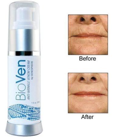Buy BioVen Anti-Wrinkle Venom Cream by Biologic Solutions | 1 oz | Rejuvenate Skin & Reduce Wrinkles - Fast International Shipping - Buy Online on GoSupps.com