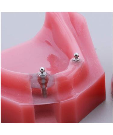 Fhuili Teeth Model for Education | Dental Implant Repair & Communication | Red Dentition Simulation Tool - Buy Online on GoSupps.com