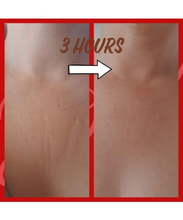 Alluring Alice Reusable Silicone Anti Wrinkle Chest Pad - Wrinkle Prevention for Smooth, Firm, and Tight Skin - 1 Count - Buy Online on GoSupps.com