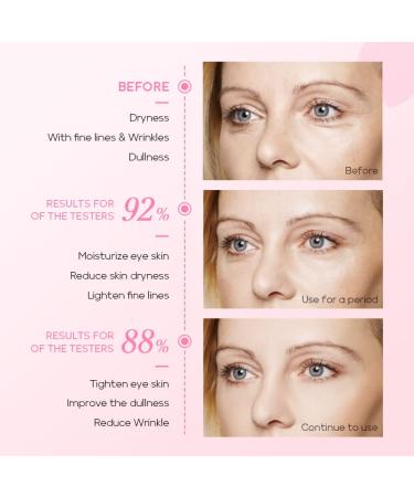 AKARY Cherry Blossom Eye Roller Serum Eye Moisturizer, Deep Hydration Eye Serum with Caffeine and Sodium Hyaluronate, Under Eye Cream to Reduce Dark Circles, Fine Lines, Smoothing Skin Care Treatment - Buy Online on GoSupps.com