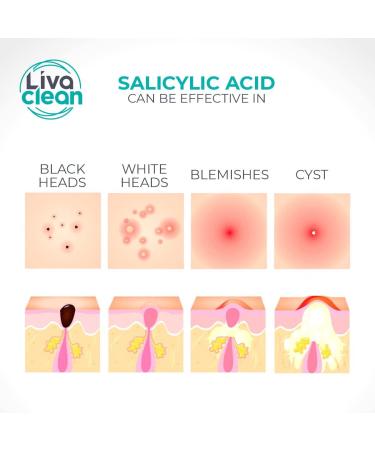 Livaclean (120 Count 3 Pack) Mixed bundle of Regular (48) Salicylic Acid (36) and T.Tree (36) Hydrocolloid Patches + 10 Count Large Square Patches 130 Count Mixed Pack - Buy Online on GoSupps.com