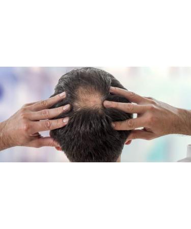 Kerastim Pro Biotin Conditioner - Hair Growth Serum for Stronger, Thicker Hair | Regrowth Treatment for All Hair Types - Buy Online on GoSupps.com