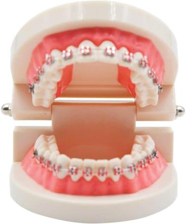 KFO Tooth Model Standard Tooth Teaching Malocclusion KFO Teeth Model with Brackets Archwire Tools - Buy Online on GoSupps.com