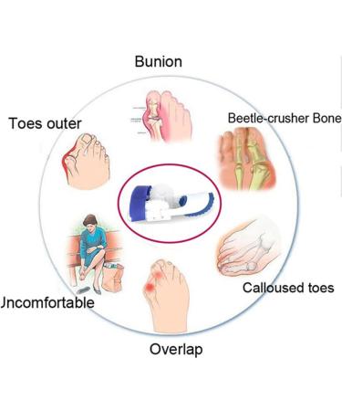 LTLCLZ Toe Separator Hallux Valgus Corrector - Set of 2 | Bunion & Toe Corrector - Buy Online on GoSupps.com