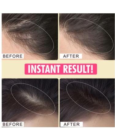 Youthcolor Hair Shading Powder - Waterproof Hairline Shadow Fibers for Fluffy Thin Hair - Black (5) - Buy Online on GoSupps.com