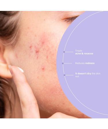 NOVA ENGEL Azelaic Radiance S rum 50 Ml - Buy Online on GoSupps.com