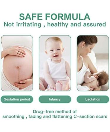 Silicone Scar Sheets - 12 Reusable Patches for Surgery, Burns, C-Section - Soften & Flatten Scars - 6 Month Supply - Buy Online on GoSupps.com