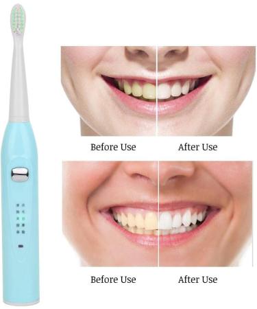 GOTOTOP Adult Electric Toothbrush | Soft Waterproof Rechargeable with 4 Brush Heads - Lake Green - Buy Online on GoSupps.com