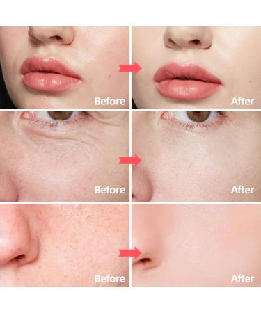 Facial Moisturizer with Retinol Hyaluronic Acid & Peptides Daily Hydrating Face Cream for All Skin Types - Buy Online on GoSupps.com