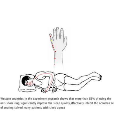 Adjustable Anti-Snoring Ring for Men and Women - Acupressure Treatment Device (S) - Buy Online on GoSupps.com