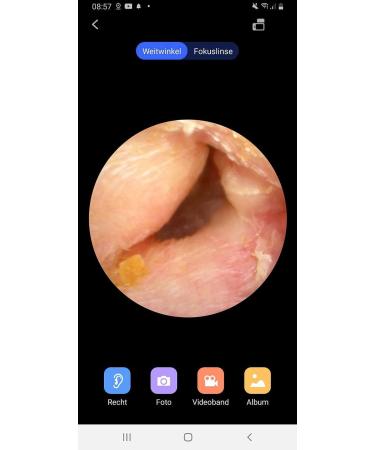 Newgen Medicals Earrkamera: WiFi Ear Cleaner with Full HD Camera Live App View & 8 Ear Tips - Ultimate Ear Health Solution - Buy Online on GoSupps.com