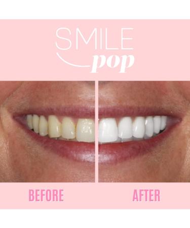 Smile Pop Teeth Whitening Pen - 18% Carbamide Peroxide Gel for Sensitive Teeth | Easy, Effective, Painless, Vegan & Non-Toxic Formula - Buy Online on GoSupps.com