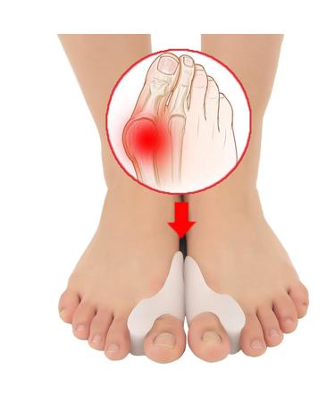 Hallux Valgus Correction Gel | Soft Silicone Foot Support for Comfortable Relief - Buy Online on GoSupps.com