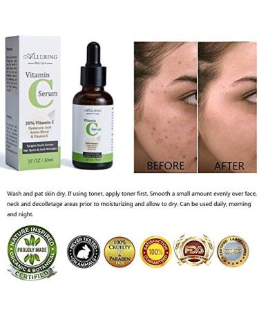 Vitamin C Facial Serum with Hyaluronic Acid & Vitamin E - Anti-Aging Acne Treatment Reduces Dark Circles & Fades Hyperpigmentation - Buy Online on GoSupps.com