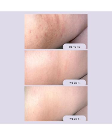 Megababe Night Rescue | Brightening & Soothing | 2.12 oz - Buy Online on GoSupps.com