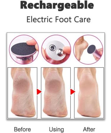 INTCHE Electric Callus Remover Foot File Foot Heel Care Tool + Sandpaper - Buy Online on GoSupps.com