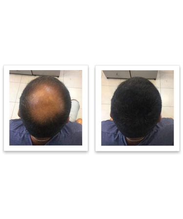 FEBRON Spray Applicator Pump - Easy and Precise Hair Extension Application - Buy Online on GoSupps.com