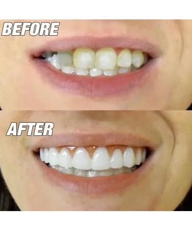 Buy Iksvmsi 4-Piece False Teeth Veneers - Temporary Dentures for Men & Women - Perfect for Bad Teeth - International Shipping Available - Buy Online on GoSupps.com