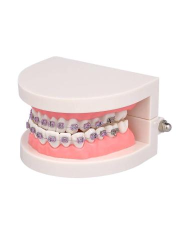 Dytah tooth orthodontic demonstration model demonstration teeth model treatment model with metal-arch wire explanatory model with brackets for teeth teach study model