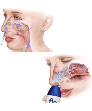 FLO Sinus Care Starter Kit - Complete Nasal Irrigation System - Buy Online on GoSupps.com