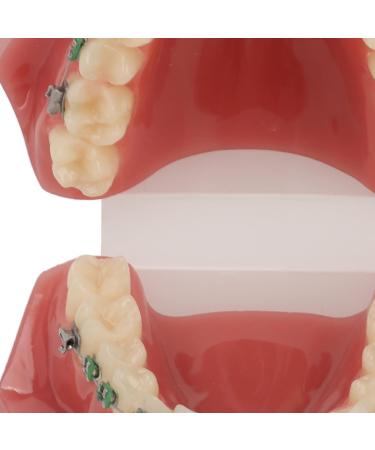 Orthodontic Bracket Model - Dental Resin Model & Portable Metal Wire for Student Learning - Buy Online on GoSupps.com