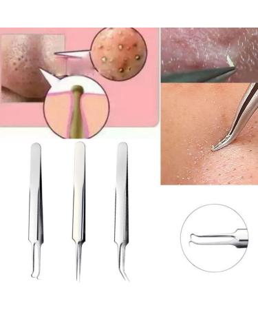 1Pc Professional Stainless Bend Curved Tweezer Blackhead Acne Clip Comedone Pimple Extractor Remover Tool for Comedone Whitehead Acne Blemish Bend ClipDeft and Professional - Buy Online on GoSupps.com