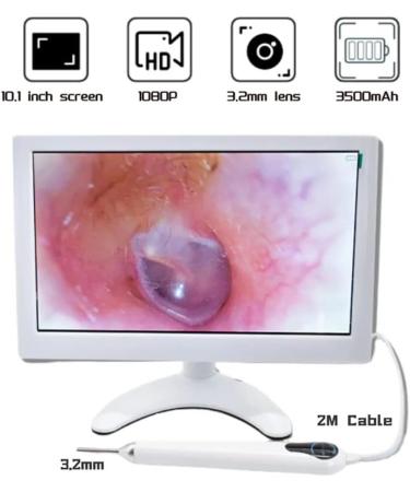 RKXKJ Ear Wax Removal Tool - Super Large 10.1 Inch IPS Screen Camera, 3.2mm Ear Scope, IPX6 Waterproof - Ear Care Solution - Buy Online on GoSupps.com