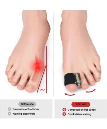 2 Pairs Toe Separator & Straightener for Men & Women - Bunion Corrector & Toe Spacers for Plantar Fasciitis - Ideal for Nighttime, Running & Yoga Practice (Size: S) - Buy Online on GoSupps.com