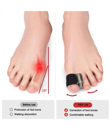 Bunion Corrector Big Toe Brace Sleeves - 2 Pairs Soft Breathable Hallux Valgus Splint for Foot Pain Relief - Orthopedic Hammer Toe Straightener for Women & Men - Buy Online on GoSupps.com
