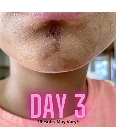 Buy RICHSKIN.co Original SOS Shea Butter for Face & Body | Healing Essential Oil Blend Nourish and Revitalize Your Skin - Buy Online on GoSupps.com