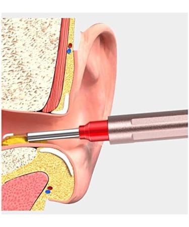 Ear Wax Removal Ear Wax Removal Tool 500W HD Wireless Ear Endoscope 3.9mm Extremely Fine Waterproof WiFi Ear Wax Removal Otoscope with 8 LED Light Compatible iPhone Android Smartphones Rose Gold - Buy Online on GoSupps.com