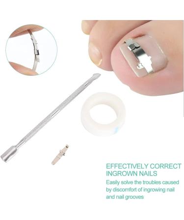 Ingrowing Nail Corrector Ingrown Toenails Correction Paronychia Corrector Ingrowing Nail Corrector Ingrown Toenail Correction Paronychia Ingrown Toenail Correction Tool Foot Care Tool (set 40) - Buy Online on GoSupps.com