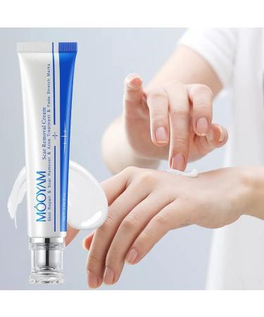Harsha Tamoskiny Scar Removal Cream 30g - for Stretch Marks, Surgery, Injuries & Burns - All Skin Types - Buy Online on GoSupps.com