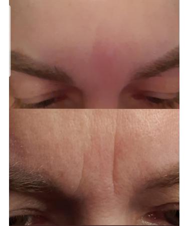 Livegood Instant Youth & Valentus Ageless Anti-Aging Face Serum Set - Best Internationally Shipped Skincare - Buy Online on GoSupps.com