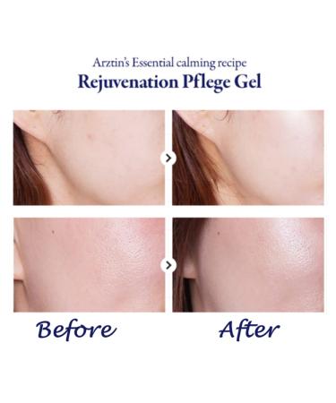 ARZTIN Rejuvenation Gel Essence - Face & Body Smoothing After Sun with Aloe - 4.4 FL.Oz - Buy Online on GoSupps.com