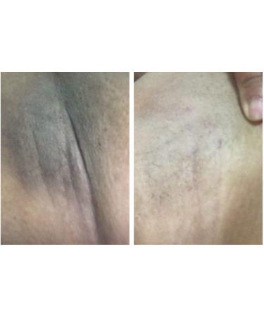 Oriental Princess Underarm Care Pure White Secret Cream 50g - Brightening Armpit Cream - Buy Online on GoSupps.com