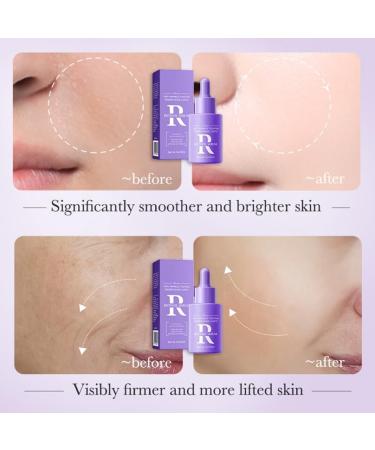 Retinol Serum Anti Aging Retinol Serum for Face & Neck Cream Serum for Smoothing Fine Lines and Skin Brightening Anti Wrinkle Serum for Skin Repair Acne Scar Dark Spot Fine Line and Wrinkles - Buy Online on GoSupps.com