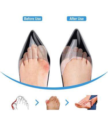 DOACT 3-Hole Bunion Corrector Protector with 5-Hole Big Toe Straighteners Gel Toe Separator Foot Splint Support for Hallux Valgus Overlapping Hammer Turf Bent Toe Day and - Buy Online on GoSupps.com