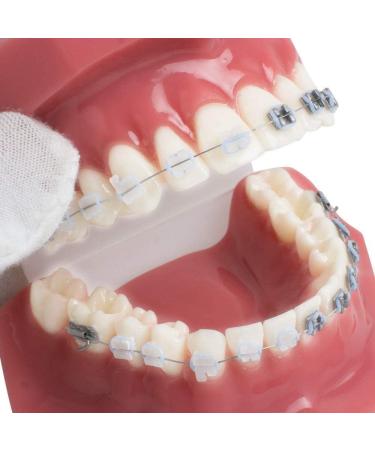 Orthodontic Dental Teeth Model with Metallic & Ceramic Brackets - Ideal for Dentist Patient Communication | Gylejwh - Buy Online on GoSupps.com